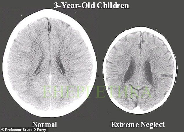 Това са мозъците на две 3-годишни деца: Едното е с добри родители, другото е с лоши…