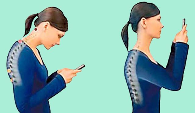 „Синдромът на компютърната шия“: Смартфонът и компютърът предизвикват болести и  стареене на лицето